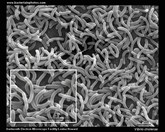 vibrio cholerae SEM